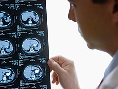 Clinican's see the patient's coma scale rating on all records, including xrays.
Credit: Getty Images Clinican's see the patient's coma scale rating on all records, including xrays.
Credit: Getty Images