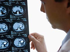 Clinican's see the patient's coma scale rating on all records, including xrays.  
Credit: Getty Images